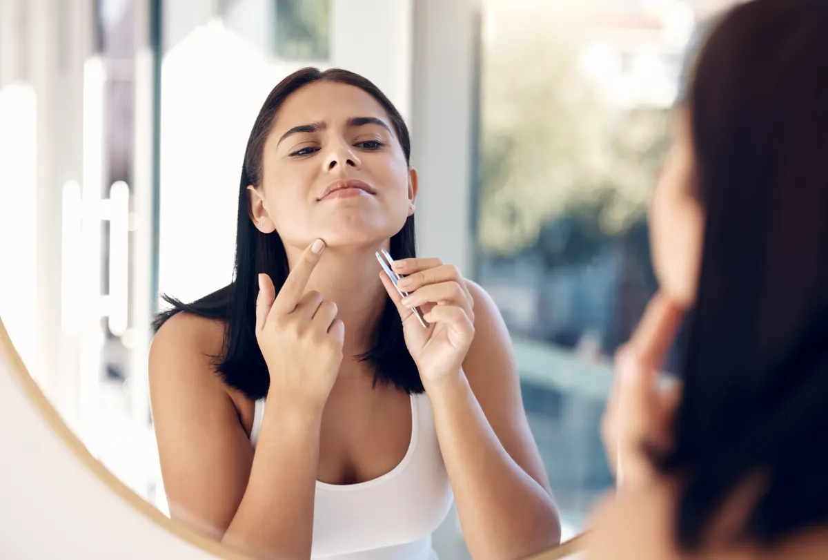 Acne treatment marketing agency: face, hair removal and woman chin with tweezers for beauty, skincare and dermatology for morning routine. Cosmetics treatment, facial health cleaning and hair wellness or hygiene grooming in mirror.