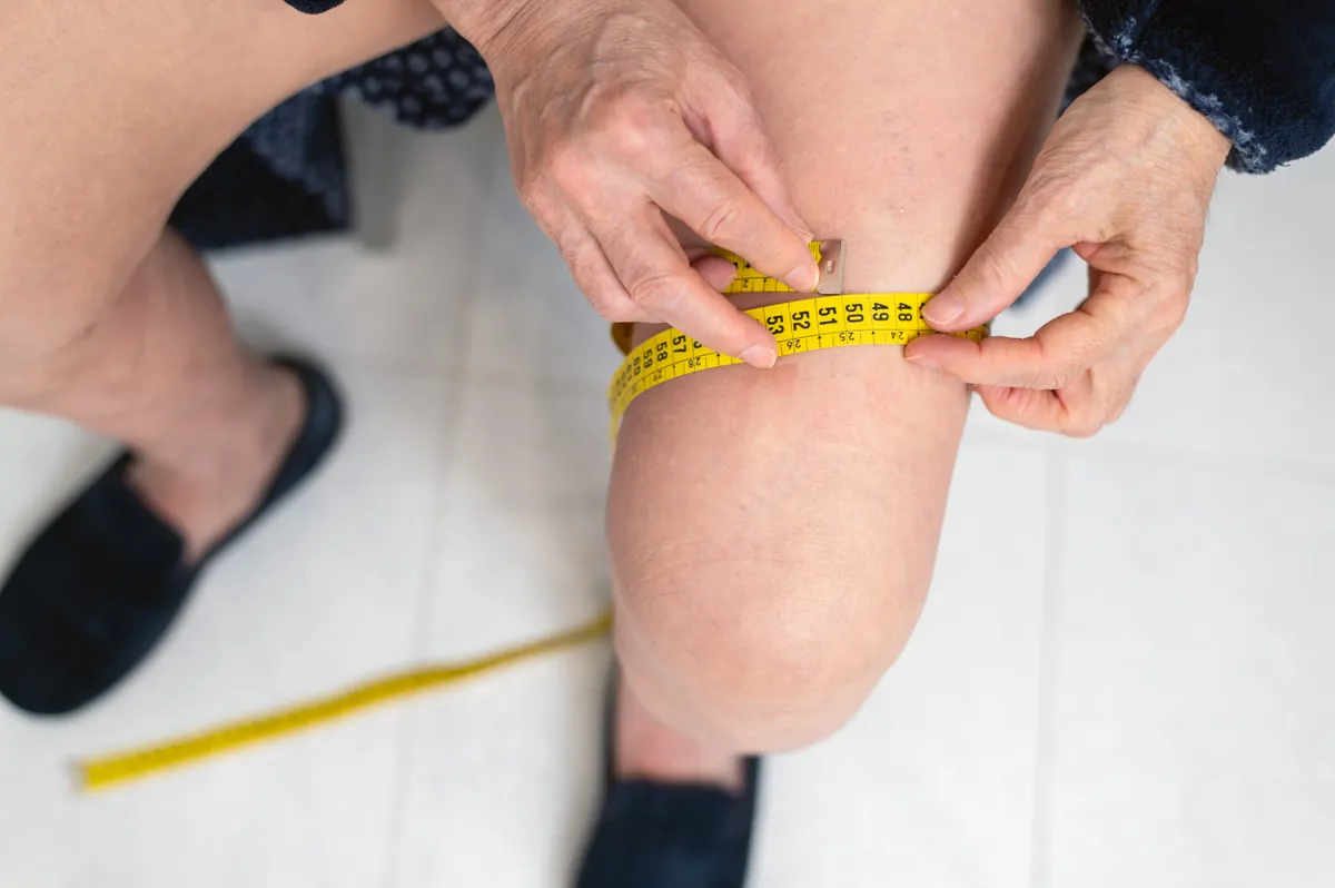 Orthopedic support marketing agency: close up view of an elderly woman measuring the circumference of a swollen leg with a tape measure to monitor lymphedema progression and support ongoing medical care, treatment planning, and symptom management at home.